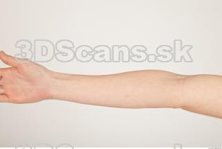 Photo reference of forearm 0001